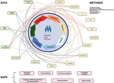 The potential of the Medical Digital Twin in diabetes management: a review